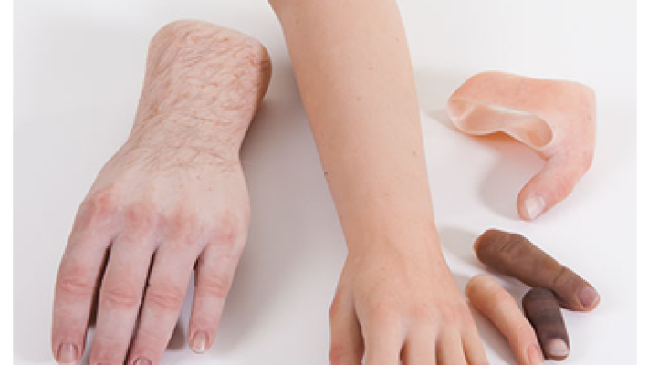 Cosmetic-Hand-Prosthesis