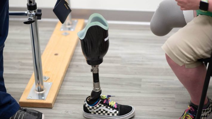 manage-phantom-limb-pain-texas-prosthetic-systems