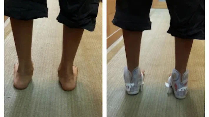 Pro Ortho Perfect India Pvt. Ltd.