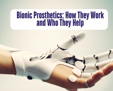 Bionic Prosthetics How They Work and Who They Help