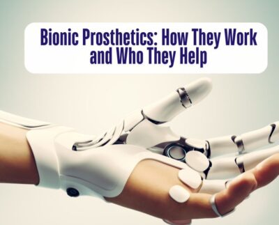 Bionic Prosthetics How They Work and Who They Help