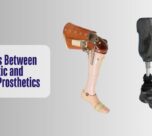 Differences Between Cosmetic and Functional Prosthetics