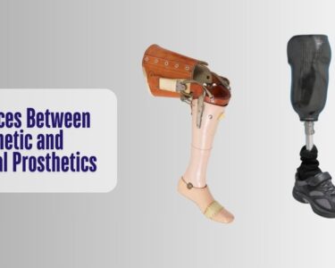 Differences Between Cosmetic and Functional Prosthetics