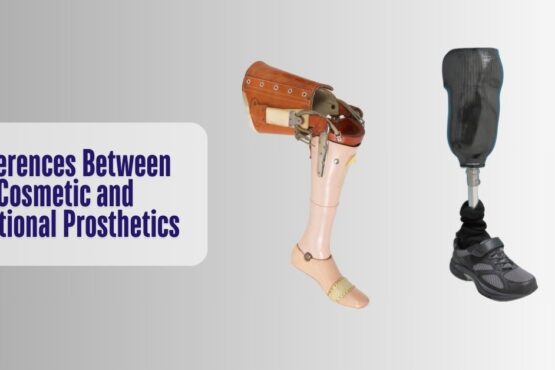 Differences Between Cosmetic and Functional Prosthetics