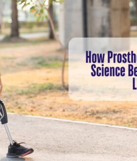 How Prosthetics Work The Science Behind Artificial Limbs