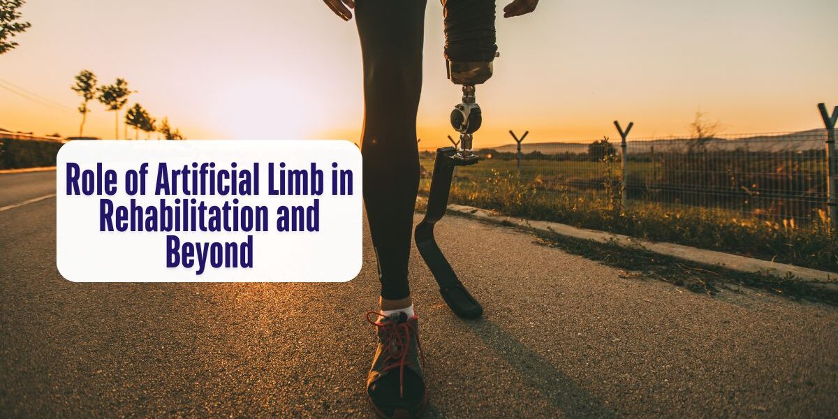 Role of Artificial Limb in Rehabilitation and Beyond