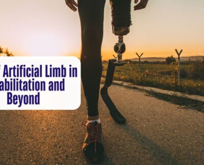 Role of Artificial Limb in Rehabilitation and Beyond