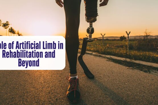 Role of Artificial Limb in Rehabilitation and Beyond