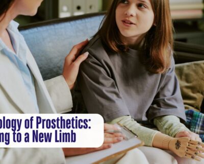 The Psychology of Prosthetics Adjusting to a New Limb