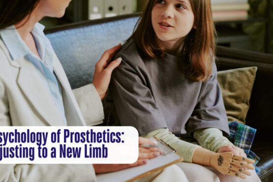 The Psychology of Prosthetics Adjusting to a New Limb