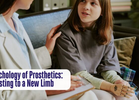 The Psychology of Prosthetics Adjusting to a New Limb