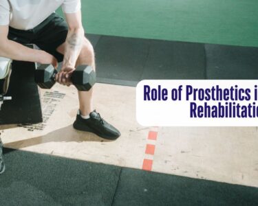 The Role of Prosthetics in Physical Rehabilitation