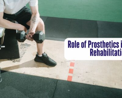 The Role of Prosthetics in Physical Rehabilitation
