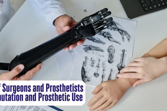 The Role of Surgeons and Prosthetists in Amputation and Prosthetic Use