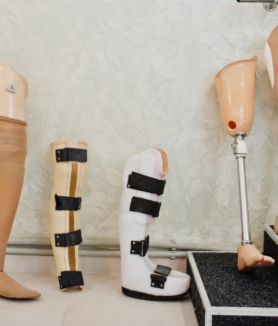 Types of Prosthetic Devices