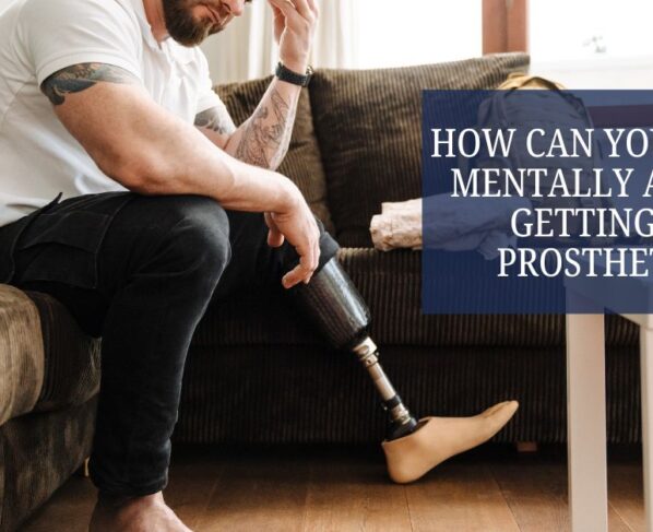 How Can You Cope Mentally After Getting a Prosthetic