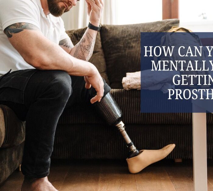 How Can You Cope Mentally After Getting a Prosthetic