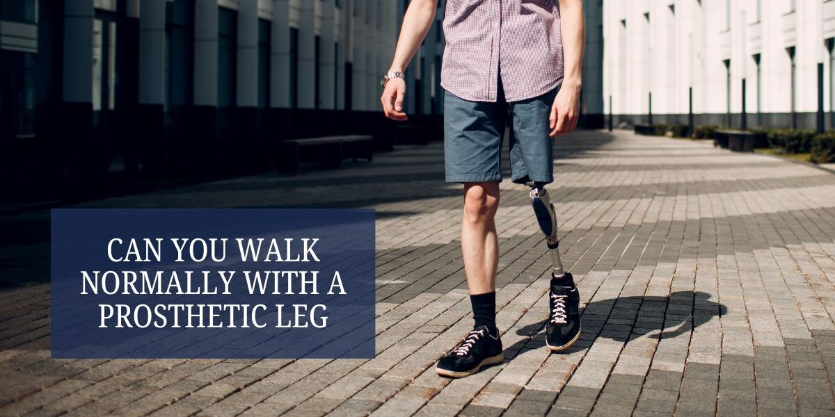Can You Walk Normally with a Prosthetic Leg