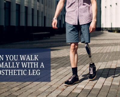 Can You Walk Normally with a Prosthetic Leg