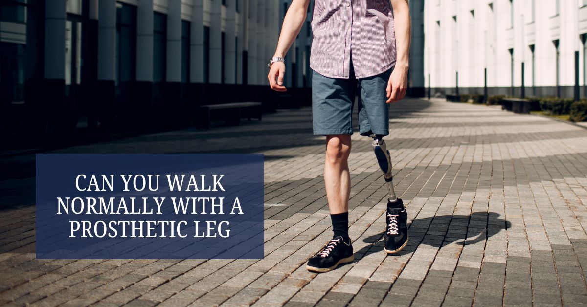 Can You Walk Normally with a Prosthetic Leg