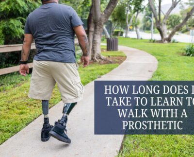 How Long Does It Take to Learn to Walk with a Prosthetic