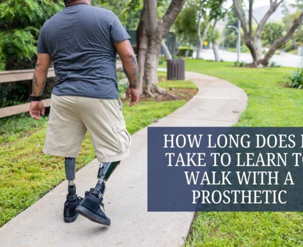 How Long Does It Take to Learn to Walk with a Prosthetic