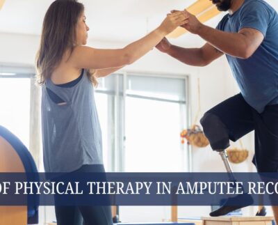 The Role of Physical Therapy in Amputee Recovery