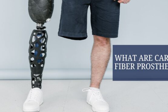 What Are Carbon Fiber Prosthetics