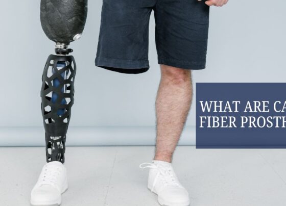 What Are Carbon Fiber Prosthetics