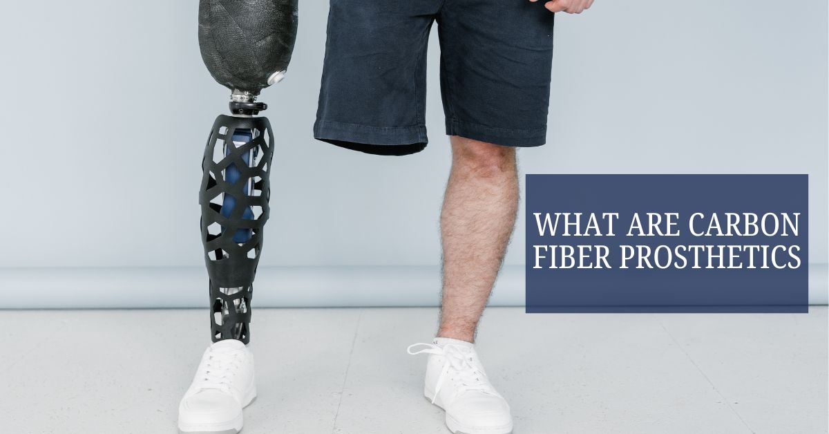 What Are Carbon Fiber Prosthetics?