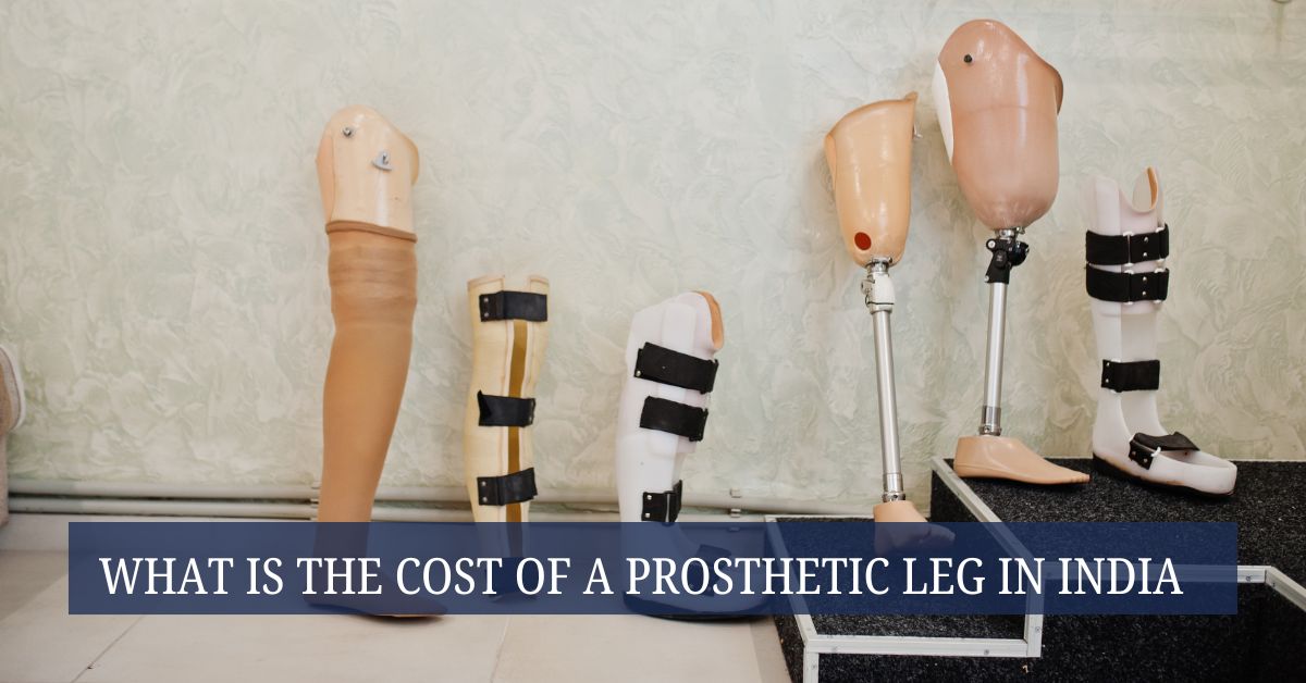 What Is the Cost of a Prosthetic Leg in India