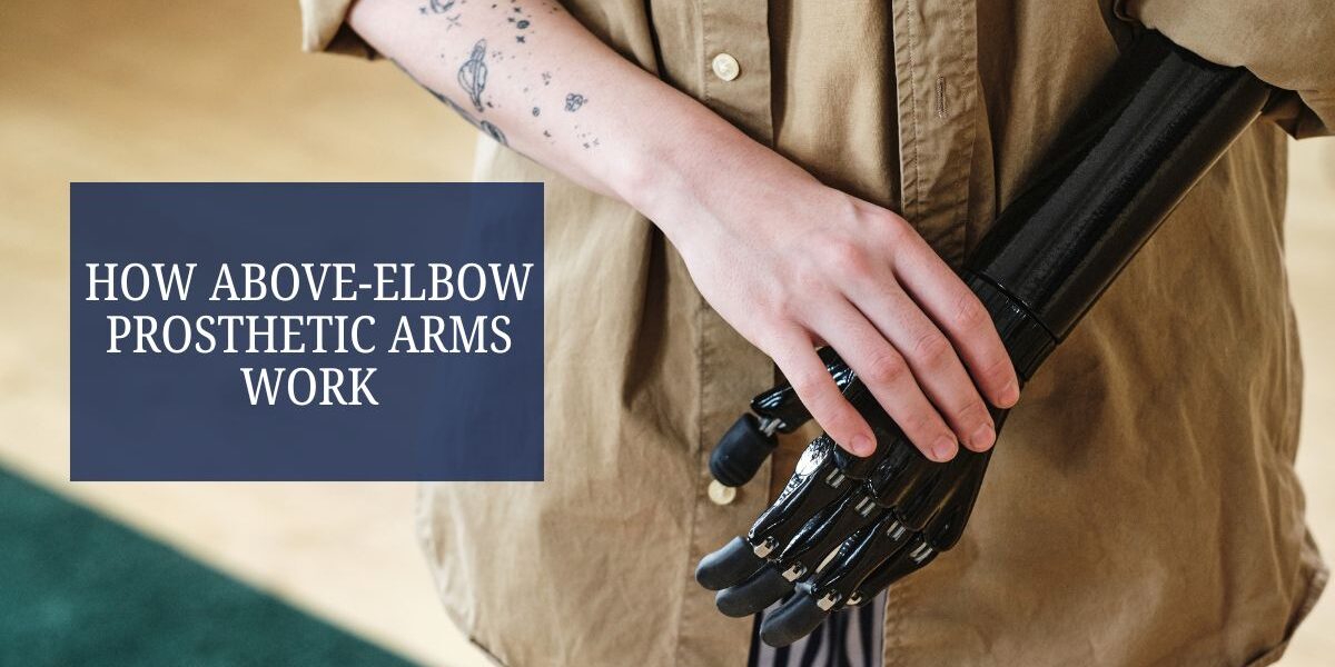How Above-Elbow Prosthetic Arms Work