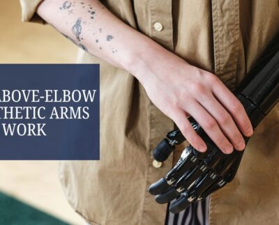 How Above-Elbow Prosthetic Arms Work