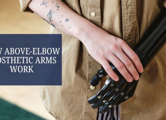 How Above-Elbow Prosthetic Arms Work
