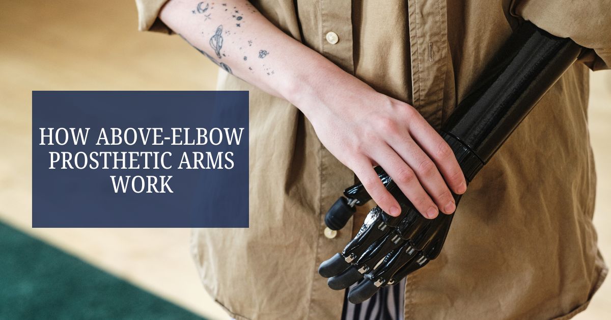 How Above-Elbow Prosthetic Arms Work ?