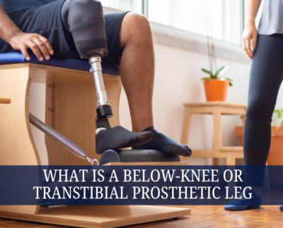 What Is a Below-Knee or Transtibial Prosthetic Leg