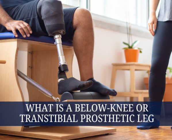 What Is a Below-Knee or Transtibial Prosthetic Leg
