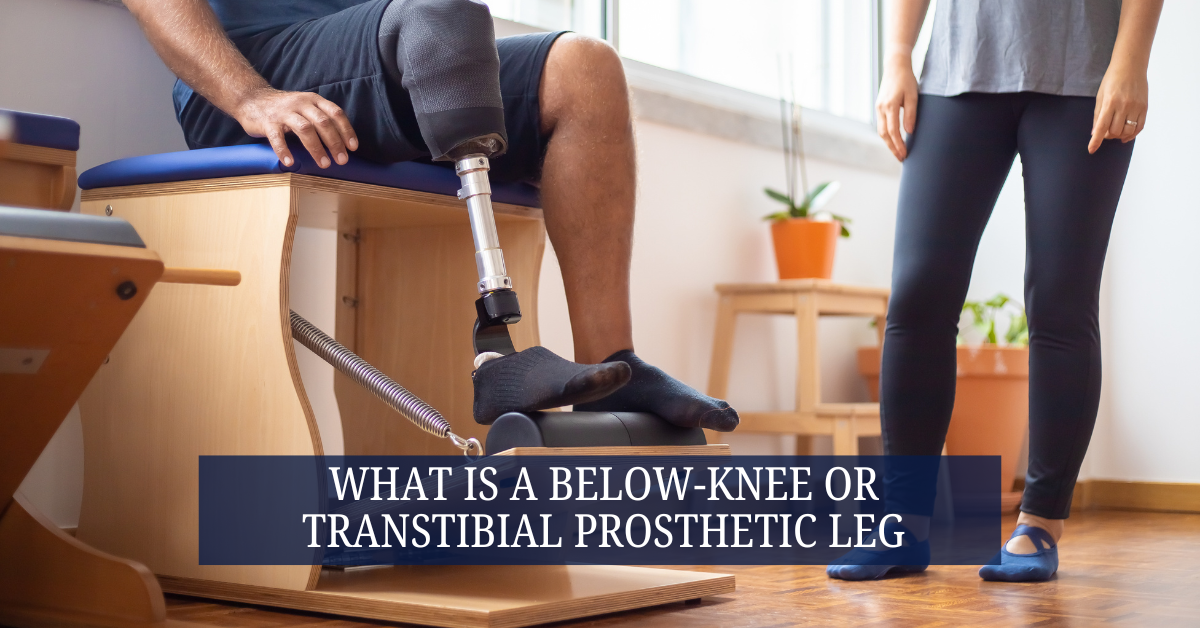 What Is a Below-Knee or Transtibial Prosthetic Leg