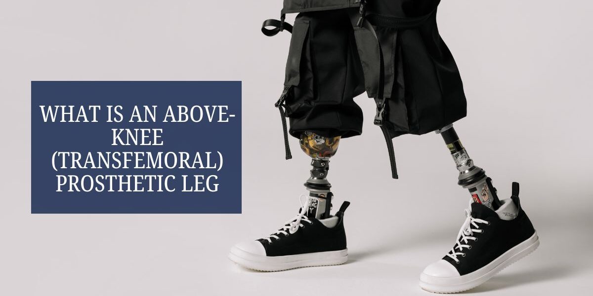 What Is an Above-Knee (Transfemoral) Prosthetic Leg