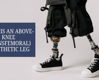 What Is an Above-Knee (Transfemoral) Prosthetic Leg