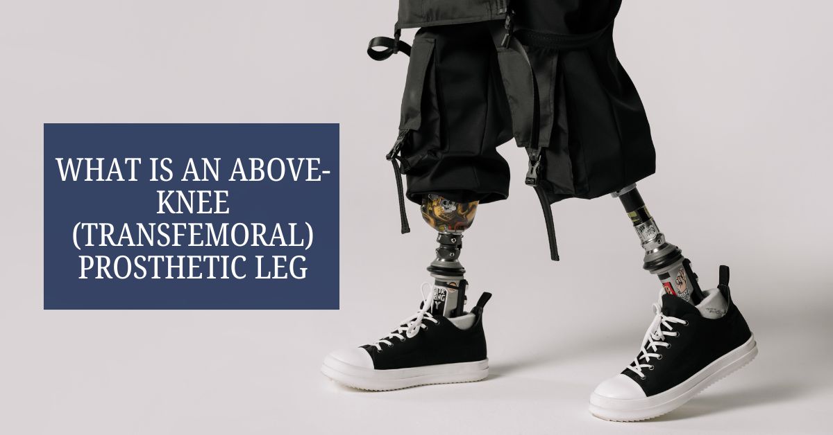 What Is an Above-Knee or Transfemoral Prosthetic Leg?