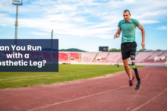 Can You Run with a Prosthetic Leg?