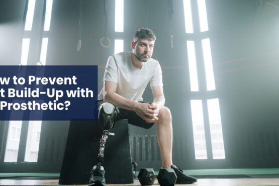 How to Prevent Sweat Build-Up with a Prosthetic?