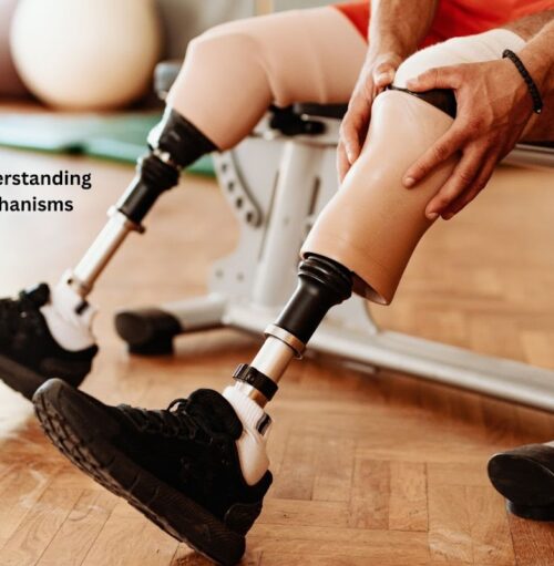 Lower Limb Prosthetics: Understanding Feet and Knee Mechanisms