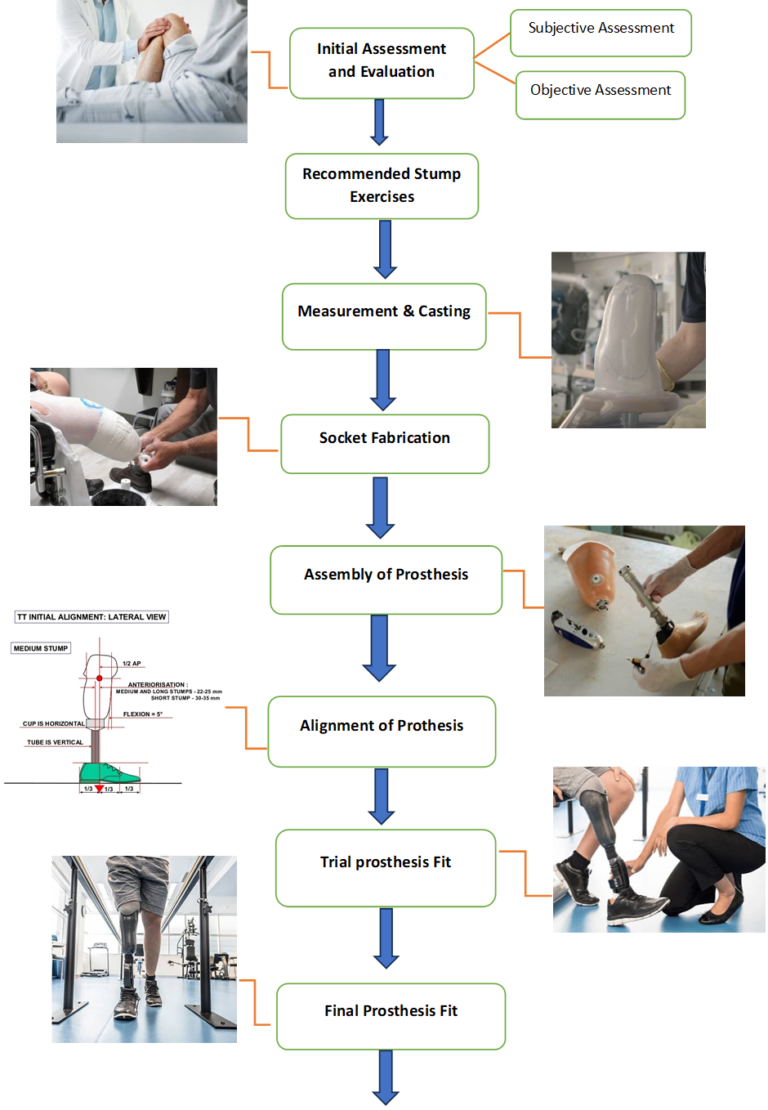 The Prosthetic Fitting Process: What to Expect?