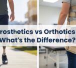The Difference Between Prosthetics and Orthotics