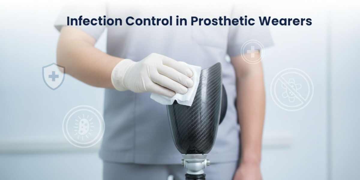 Infection Control in Prosthetic Wearers: Prevention and Treatment Protocols