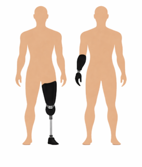 Different Types of Prosthetic Legs and Arms – Explained Simply