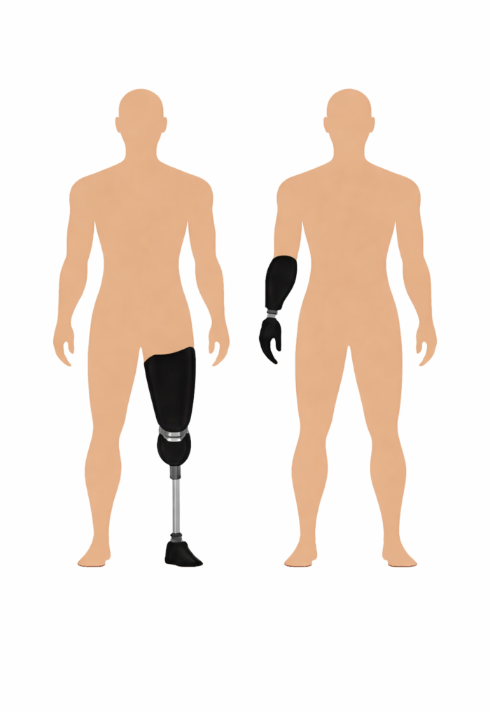 Different Types of Prosthetic Legs and Arms – Explained Simply