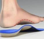 What Are Orthotic Insoles? Types, Benefits, and How They Work